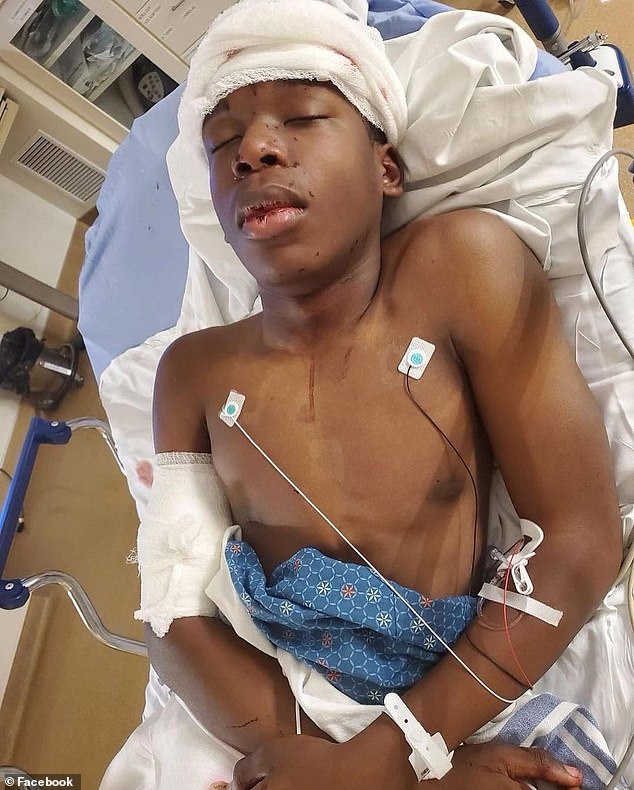 أصيب رالف يارل ، 16 عامًا ، برصاصتين في رأسه من قبل رجل أبيض بعد أن ذهب إلى المنزل الخطأ في مدينة كانساس سيتي أثناء محاولته التقاط أشقائه الصغار