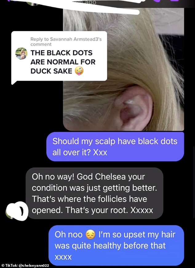 في فيديو آخر ، كشفت تشيلسي آن أن مصفف شعرها المعتاد قال إن الجذور السوداء على فروة رأسها كانت بسبب انفتاح البصيلات.