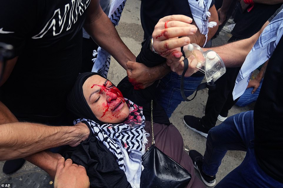 متظاهرون يحملون امرأة مصابة خلال مظاهرة تضامنية مع الشعب الفلسطيني في غزة بالقرب من السفارة الأمريكية في عوكر – إحدى الضواحي الشمالية لبيروت ، لبنان ، الأربعاء 18 أكتوبر 2023