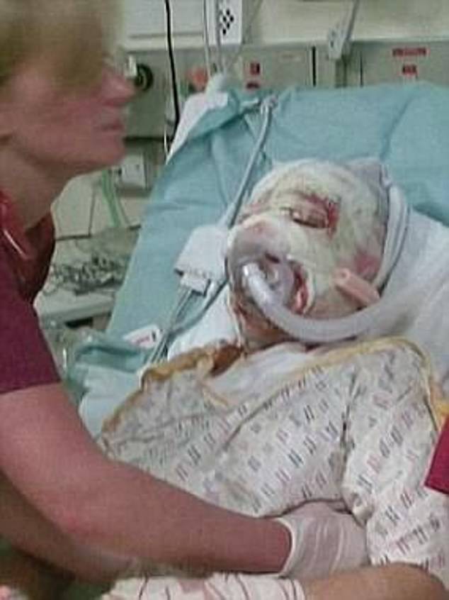 كاتي بايبر، التي عانت من إصابات خطيرة وعمى في إحدى عينيها بعد أن تعرضت لهجوم بالأسيد في سن 24 عامًا على يد صديقها السابق دانييل لينش وشريكها ستيفان سيلفستر.