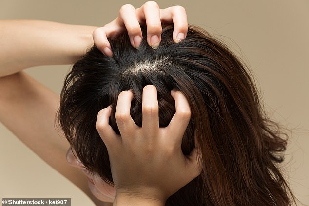 يمكن أن تؤدي الهرمونات الأندروجينية الزائدة أيضًا إلى ظهور حب الشباب وترقق الشعر وتساقط الشعر والشعر الضعيف الذي يتكسر بسهولة
