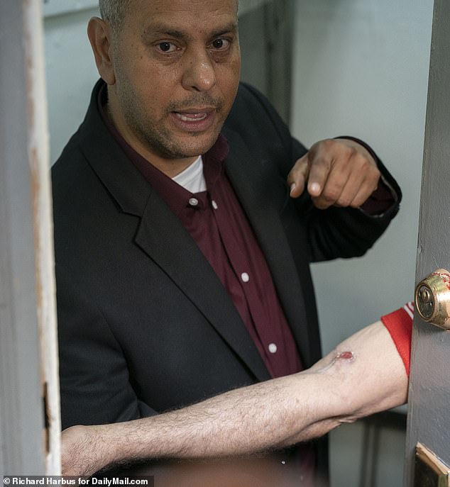 ألبا (ذراعه في الصورة) يُظهر للمصورين إصاباته إلى جانب صديقه فرانسيسكو مارتي
