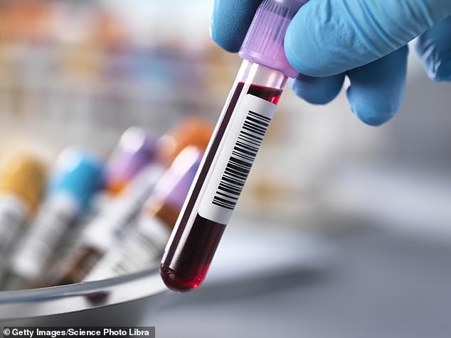 الاختبار عبارة عن سحب دم منتظم ويأتي مع تقرير عن مستويات الجزيئات المختلفة والمستقلبات والبروتينات والمواد الكيميائية في الدم، بالإضافة إلى مؤشر لمستويات الالتهاب في الجسم.