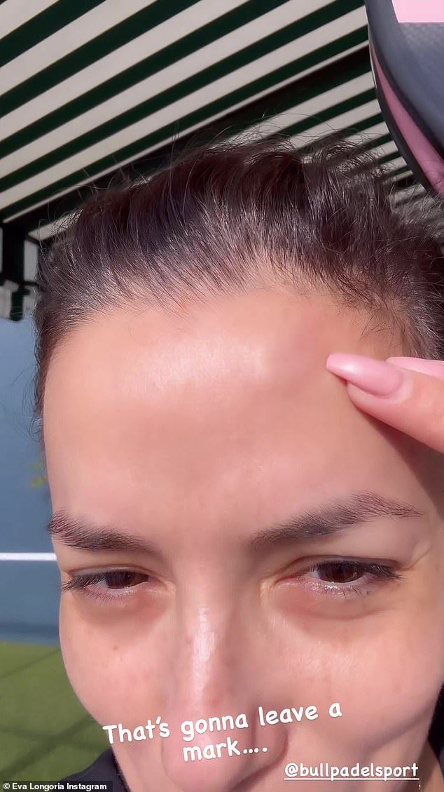 في مقطع فيديو تمت مشاركته على موقع Instagram، أشارت الممثلة إلى جبهتها المصابة بالكدمات والمتورمة بعد أن كشفت أنها تعرضت لصدمة قوية في الملعب وضربت رأسها.