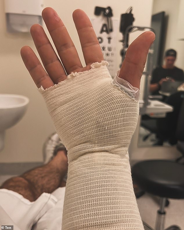 وإلى جانب صورة يده المغطاة بالضمادات أثناء وجوده في جناح الطوارئ في مستشفى ألفريد في ملبورن، كتب: 