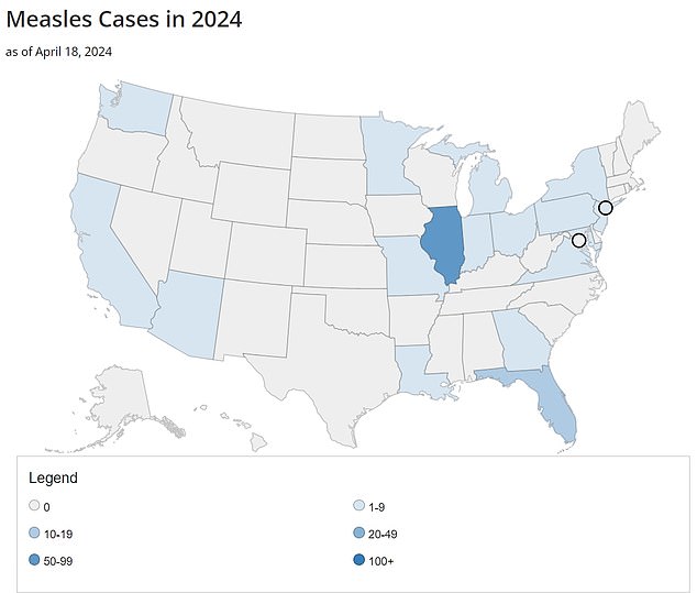وتقع شيكاغو في مركز تفشي مرض الحصبة في الولايات المتحدة، حيث تم تسجيل 58 حالة حتى الآن