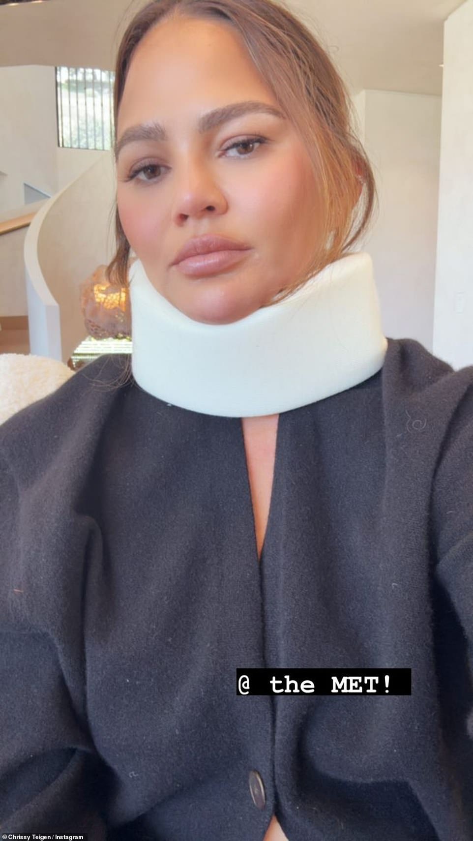 ظهرت Teigen يوم الاثنين بدعامة للرقبة على Instagram حيث أكدت أنها لن تحضر حفل Met Gala لعام 2024.  وكشفت أنها تعرضت لإصابة أثناء محاولتها الوقوف على رأسها