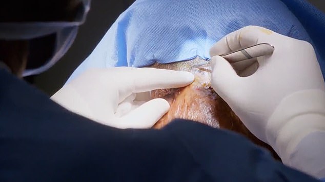 أجرى الدكتور ريان أوزبورن عملية جراحية لإزالة الكتلة من رقبة أرلين، والتي قال إنها يمكن أن تسبب ضررًا دائمًا في العمود الفقري بسبب موقعها.