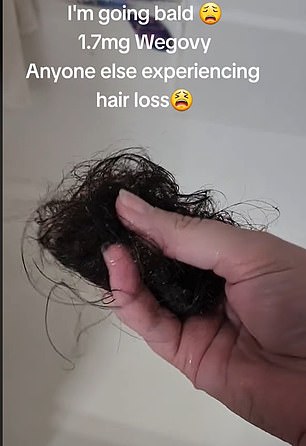 وفي الصورة أعلاه، نشرت هذه المرأة مقطع فيديو مثيرًا للقلق على TikTok، وهي تحمل خصلة من شعرها الذي تساقط أثناء الاستحمام.